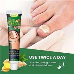 Sumifun Крем для лечения грибка ногтей Nail Fungus cream, 30гр