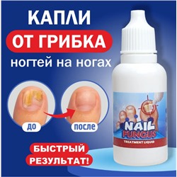 Средство от грибка ногтей на ногах / Капли от грибка Sumifun