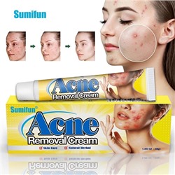 Мазь от прыщей Sumifun Acne Removal Cream, 30гр