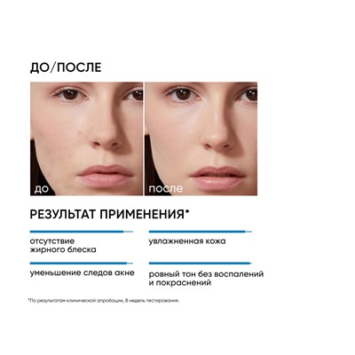 ICON SKIN Увлажняющий крем для кожи, склонной к акне Moist & Heal, 50 мл