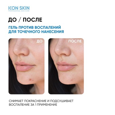 ICON SKIN Точечное SOS-средство от воспалений, 20 мл